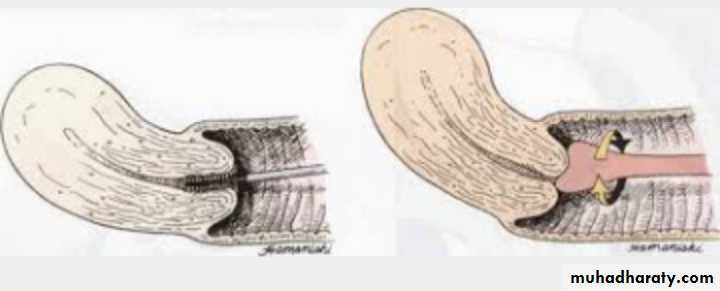 Slides of gynecology