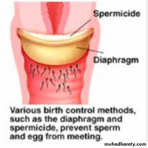 Slides of gynecology