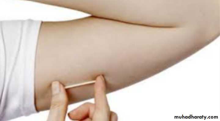 Slides of gynecology
