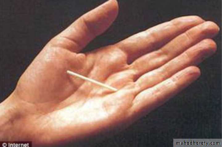 Slides of gynecology
