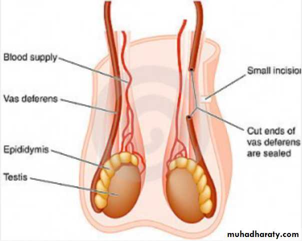 Slides of gynecology