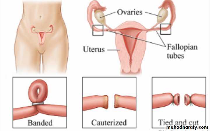 Slides of gynecology