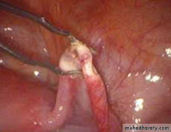 Slides of gynecology