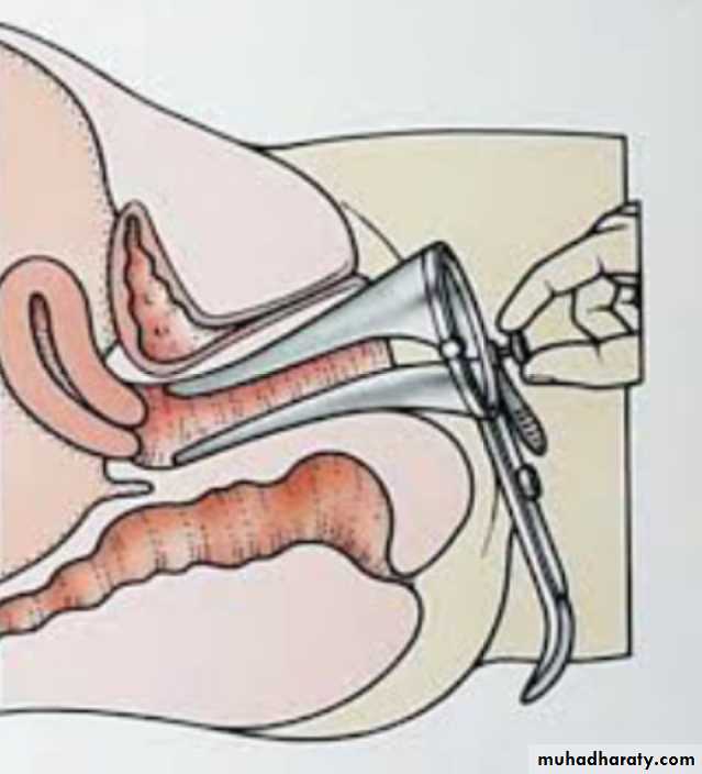 Slides of gynecology