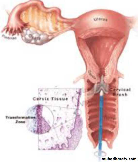 Slides of gynecology