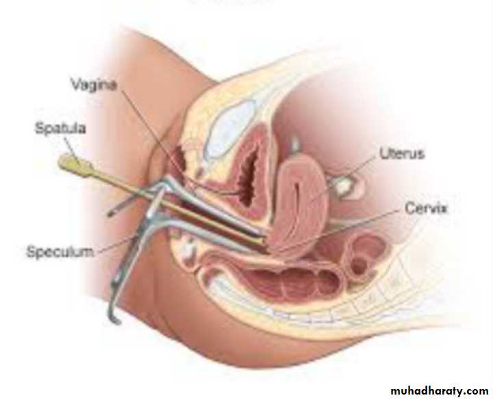 Slides of gynecology