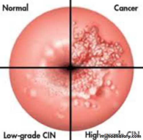 Slides of gynecology