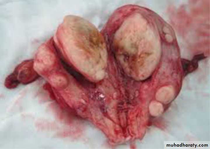 Slides of gynecology