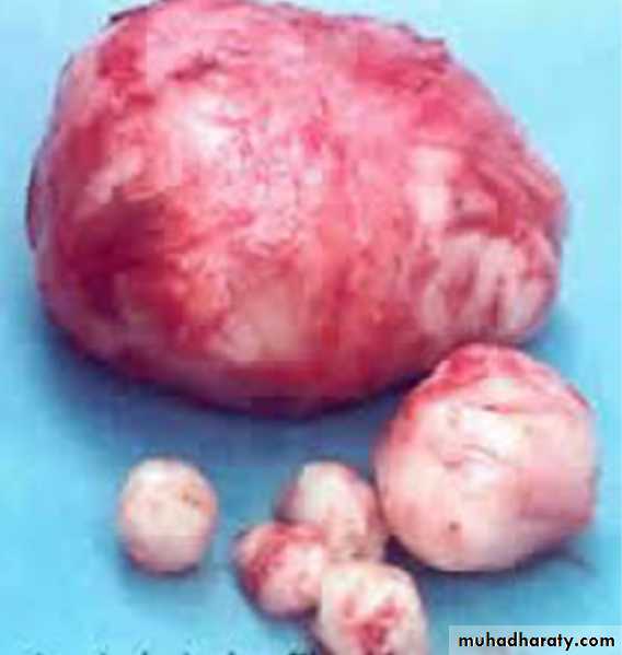 Slides of gynecology