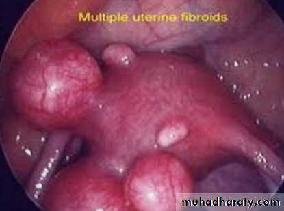 Slides of gynecology