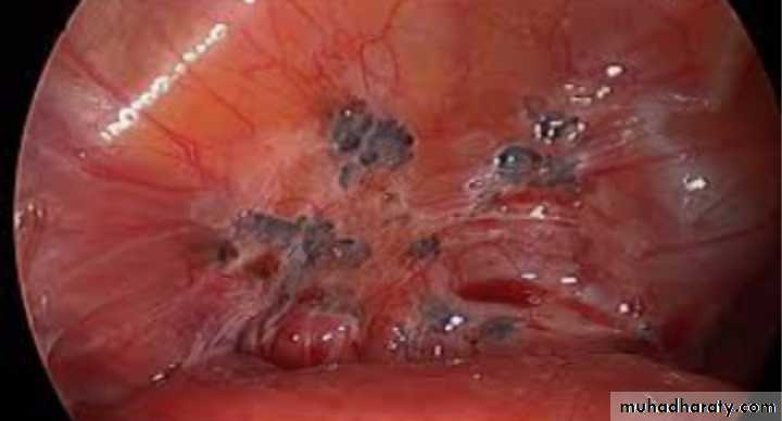 Slides of gynecology