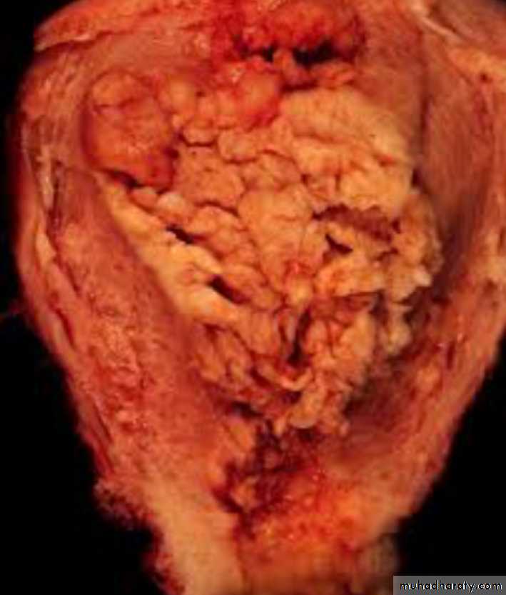 Slides of gynecology