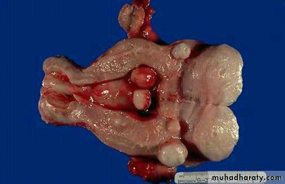 Slides of gynecology