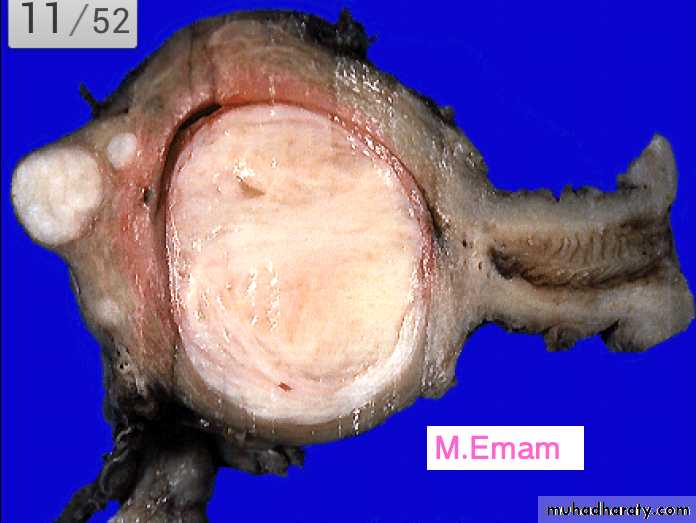 Slides of gynecology