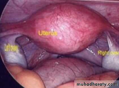 Slides of gynecology