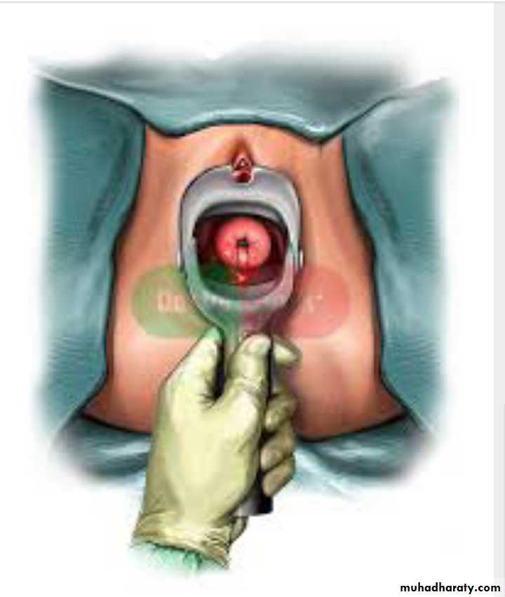 Slides of gynecology