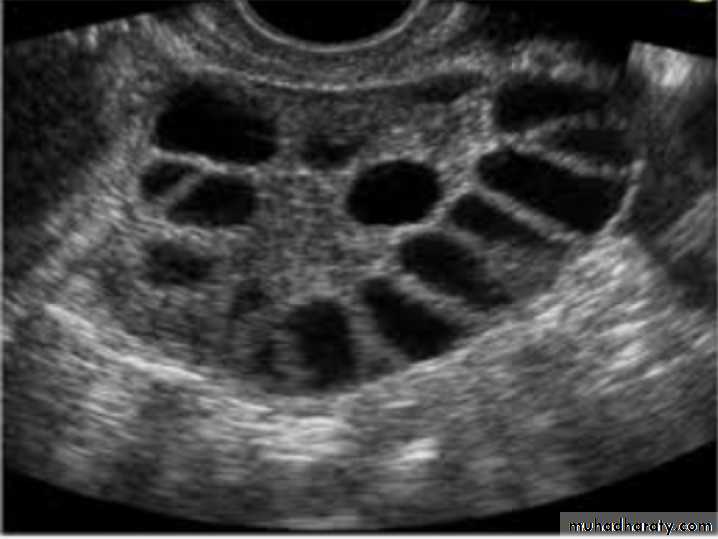 Slides of gynecology