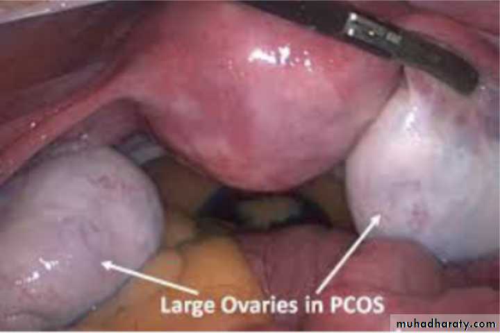 Slides of gynecology