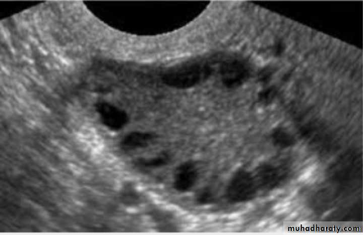 Slides of gynecology