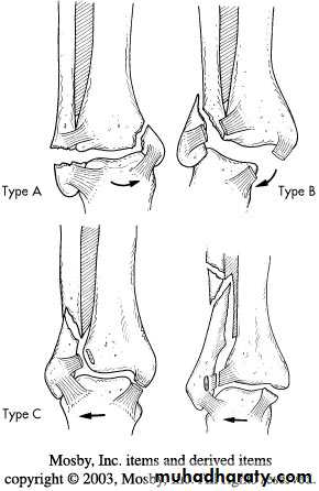 tibial and fibular injury