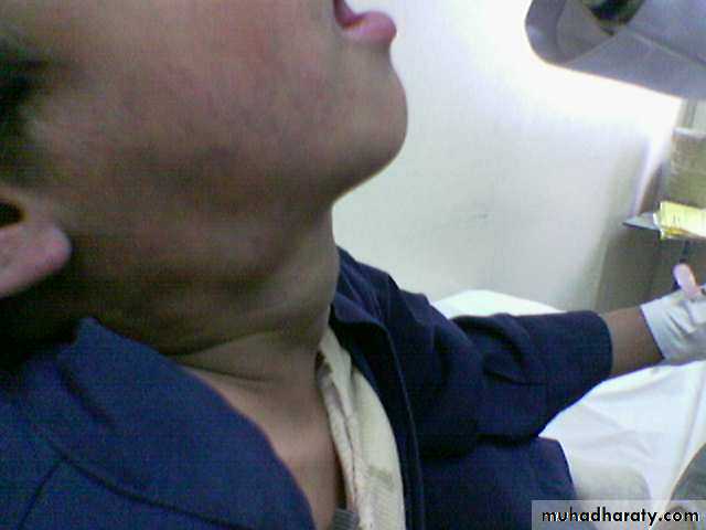 Pediatric surgery
