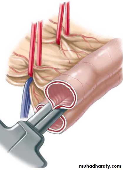Plastic surgery