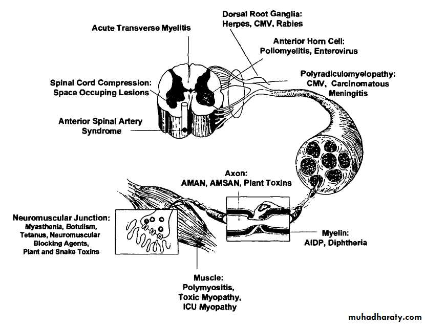 Acute flaccid paralysis