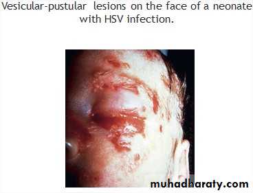 infectious disease