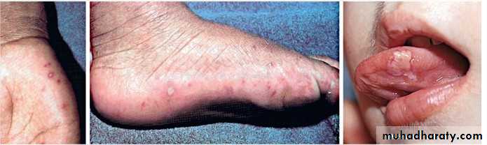infectious disease