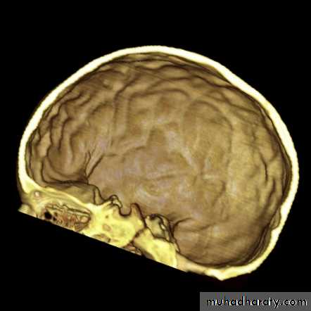 Neurosurgery