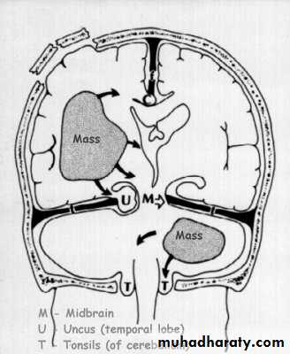 Neurosurgery