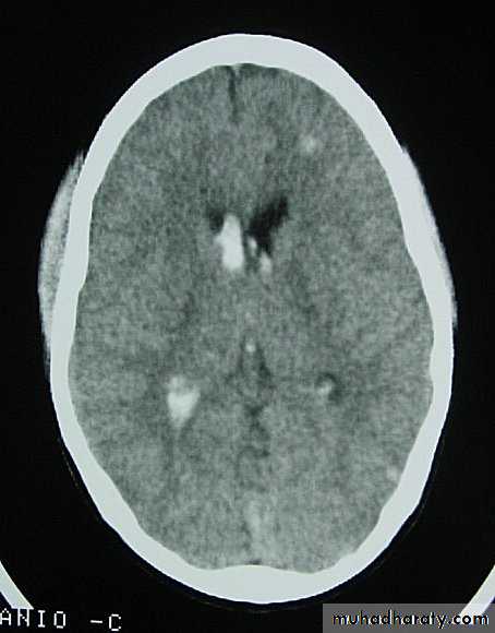 Neurosurgery