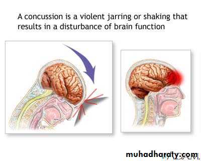 Neurosurgery