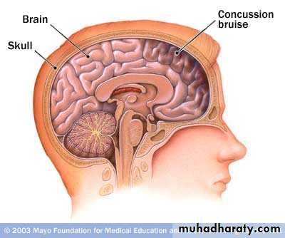 Neurosurgery