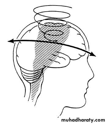Neurosurgery