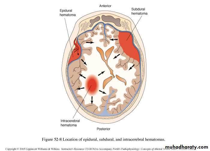 Neurosurgery