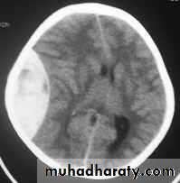 Neurosurgery
