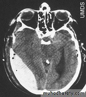 Neurosurgery