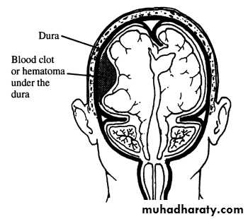 Neurosurgery