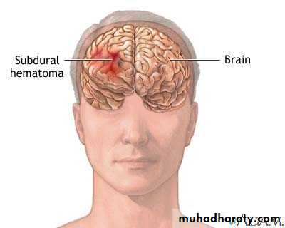 Neurosurgery
