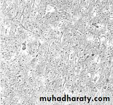 Neurosurgery