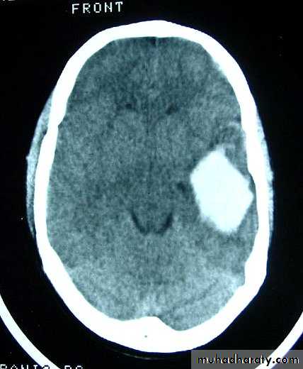 Neurosurgery