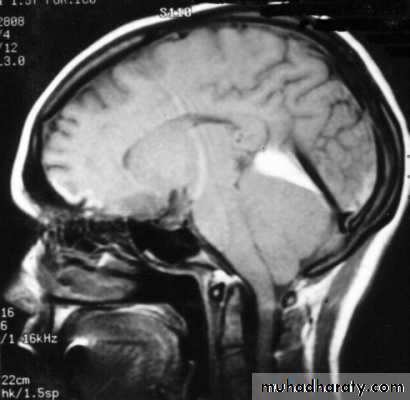 Neurosurgery