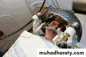 Neurosurgery