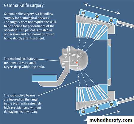 Neurosurgery