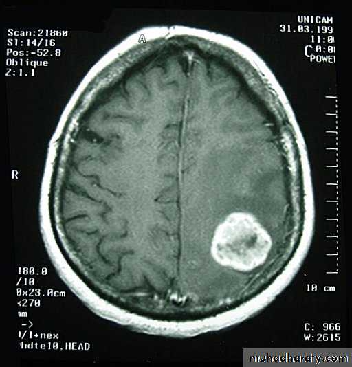 Neurosurgery