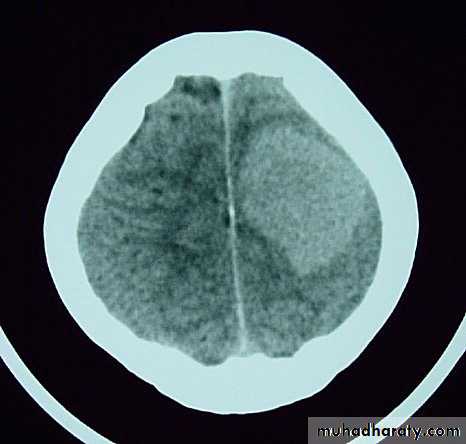 Neurosurgery