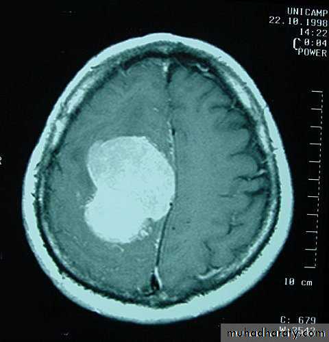 Neurosurgery