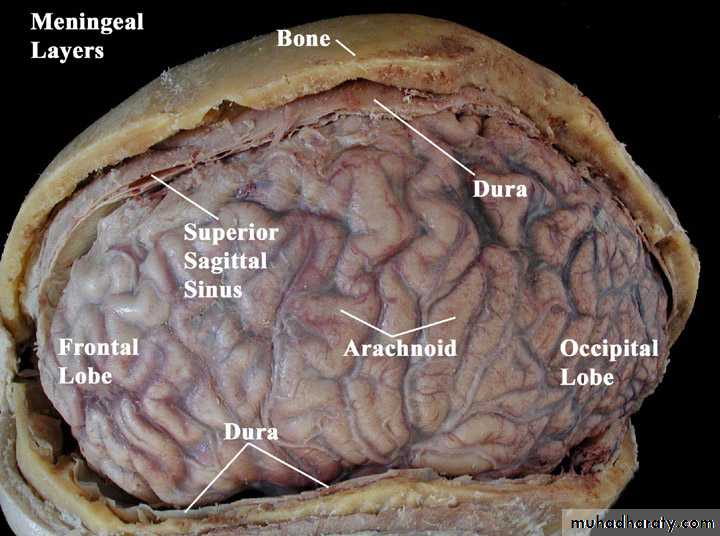 Neurosurgery