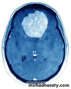 Neurosurgery